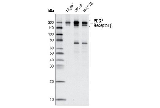 PDGF Receptor β (C82A3) Rabbit mAb