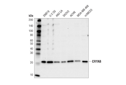 CRYAB (D6S9E) Rabbit mAb