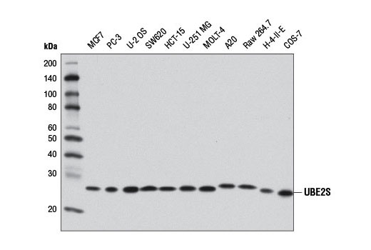 UBE2S (D5H9H) Rabbit mAb