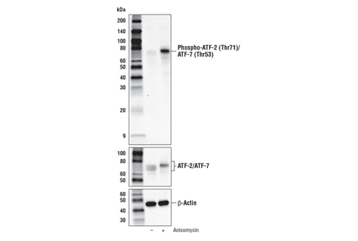 Phospho-SAPK/JNK Pathway Antibody Sampler Kit