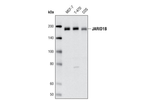 JARID1B Antibody