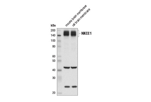NKCC1 Antibody (Rodent Specific)