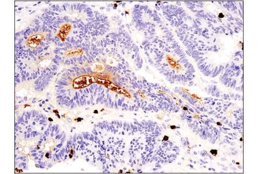 S100A9 (D5O6O) Rabbit mAb (IHC Formulated)