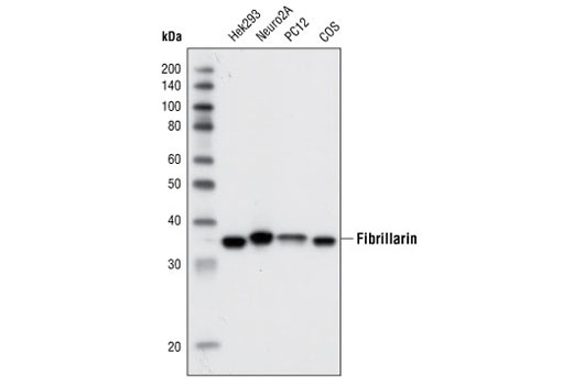 Fibrillarin (C13C3) Rabbit mAb