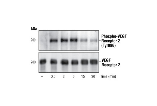 Phospho-VEGF Receptor 2 (Tyr996) Antibody