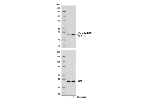 Phospho-RCC1 (Ser11) (D18B5) Rabbit mAb