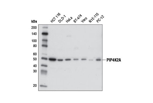 PIP4K2A (D83C1) Rabbit mAb