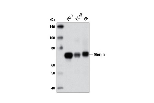 Merlin (D6N8H) Rabbit mAb