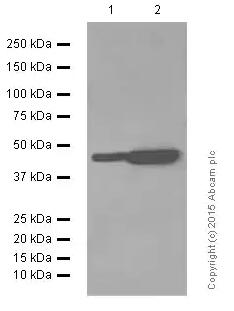 Anti-Angiotensin II Type 1 Receptor antibody [EPR3873]