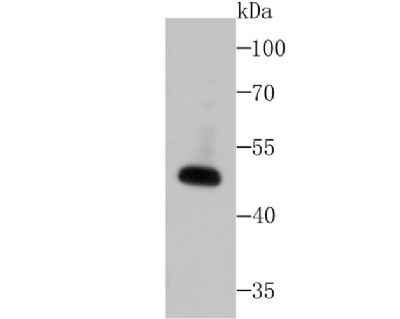信号通路Wnt2B重组兔单克隆抗体