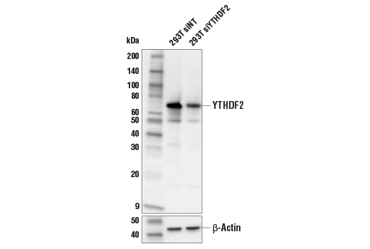 YTHDF2 (E2I2H) Rabbit mAb