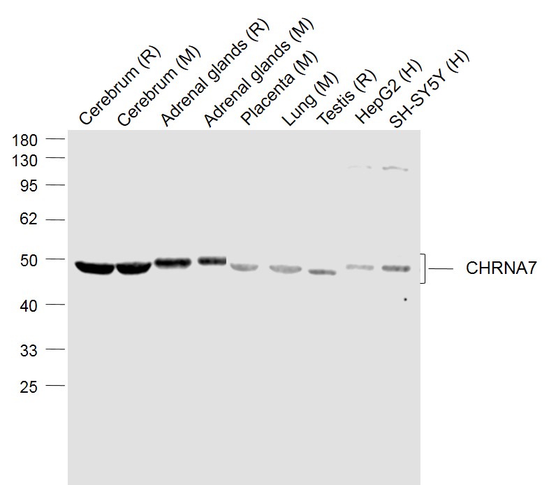 烟碱型乙酰胆碱受体a7抗体