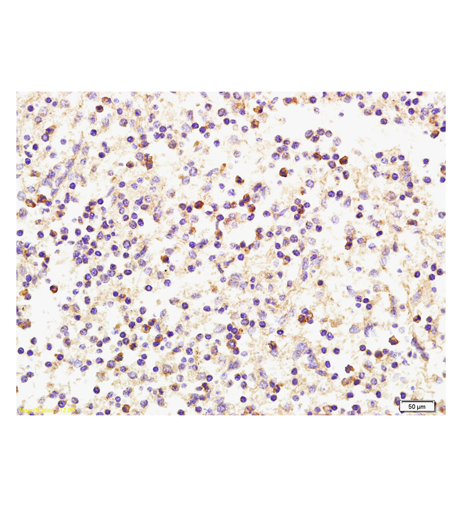 r干扰素诱导单核细胞因子抗体
