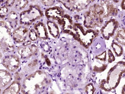 乙酰辅酶A羧化酶抗体