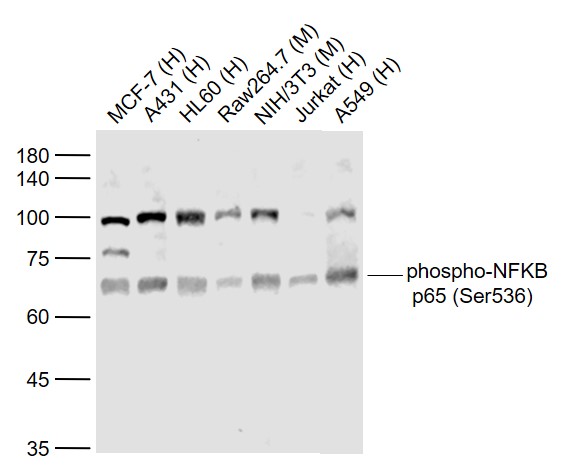 磷酸化细胞核因子抗体