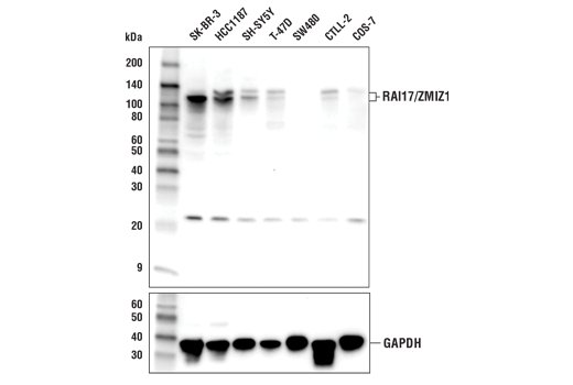 RAI17/ZMIZ1 (E2X3X) Rabbit mAb
