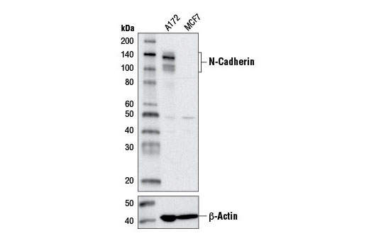Epithelial-Mesenchymal Transition (EMT) IF Antibody Sampler Kit