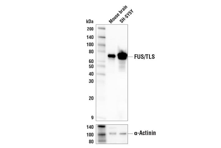 FUS/TLS (E3O8I) Rabbit mAb