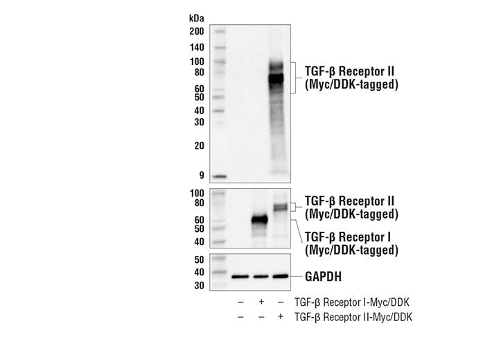 TGF-β Receptor II (E5M6F) Rabbit mAb