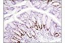 Ki-67 (D3B5) Rabbit mAb (Mouse Preferred; IHC Formulated)
