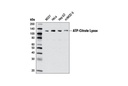 ATP-Citrate Lyase (D1X6P) Rabbit mAb