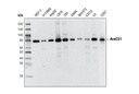 AceCS1 (D19C6) Rabbit mAb