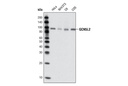 Lysine Acetyltransferase Antibody Sampler Kit
